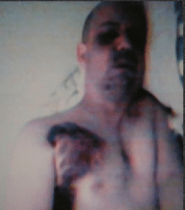 Dan Burish dopo l'aggressione. 